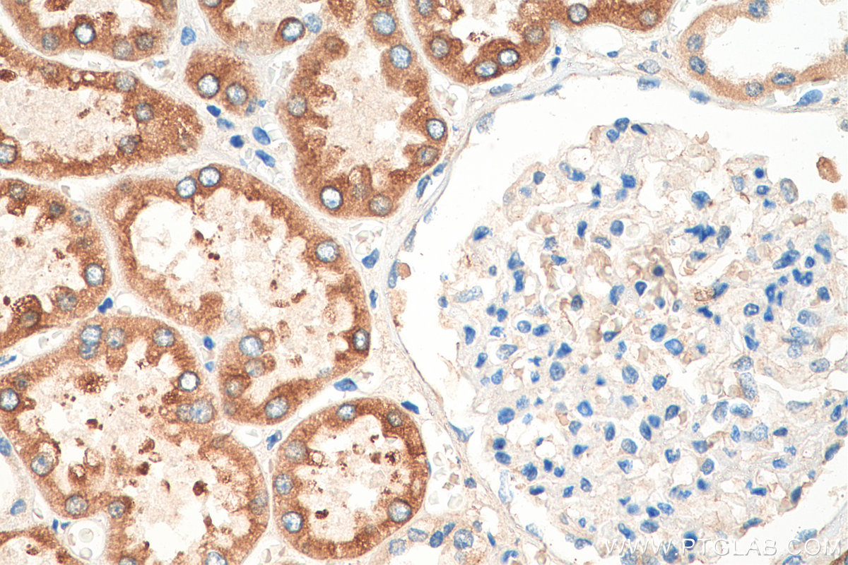 IHC staining of human kidney using 14048-1-AP