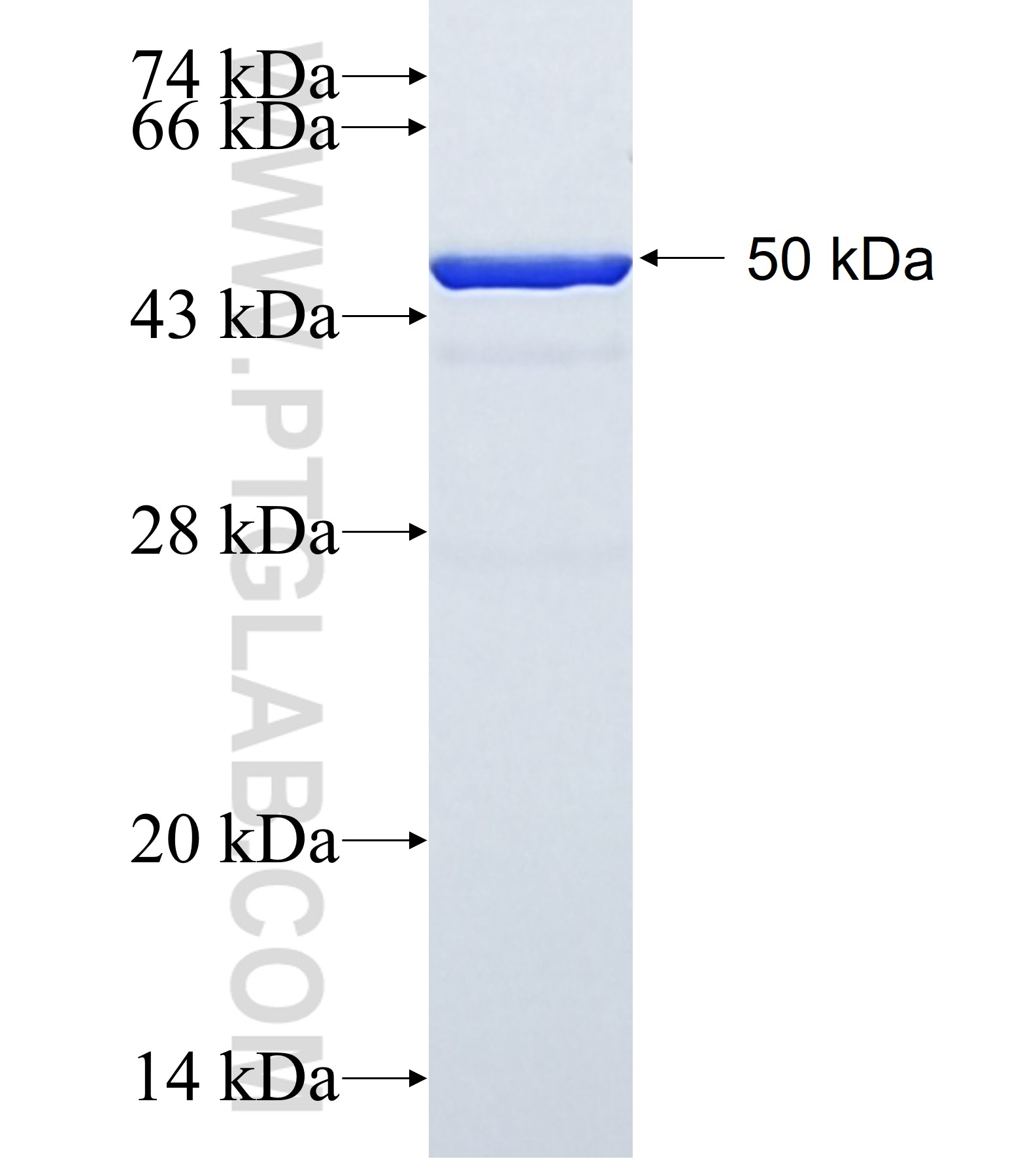SLC27A4 fusion protein Ag1490 SDS-PAGE
