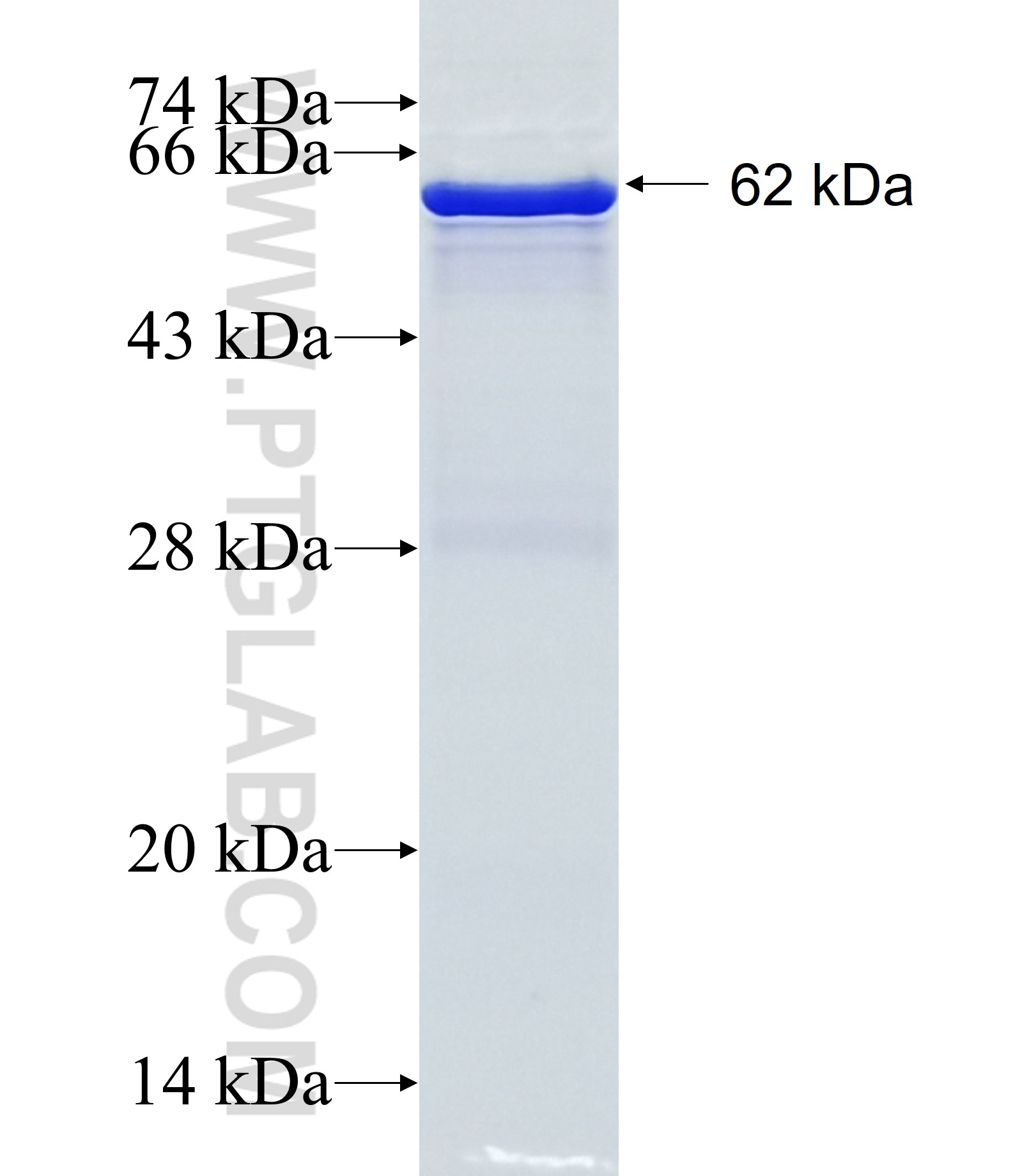 SLC27A5 fusion protein Ag18276 SDS-PAGE