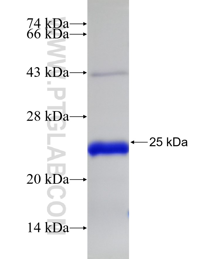SLC27A6 fusion protein Ag32185 SDS-PAGE