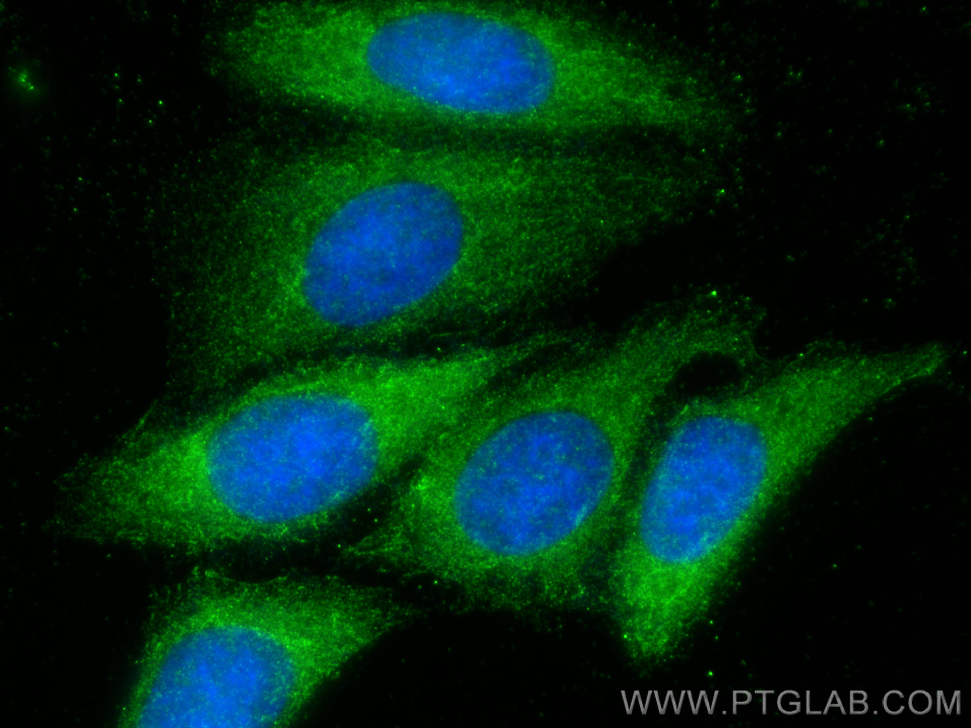 IF Staining of HepG2 using 18182-1-AP