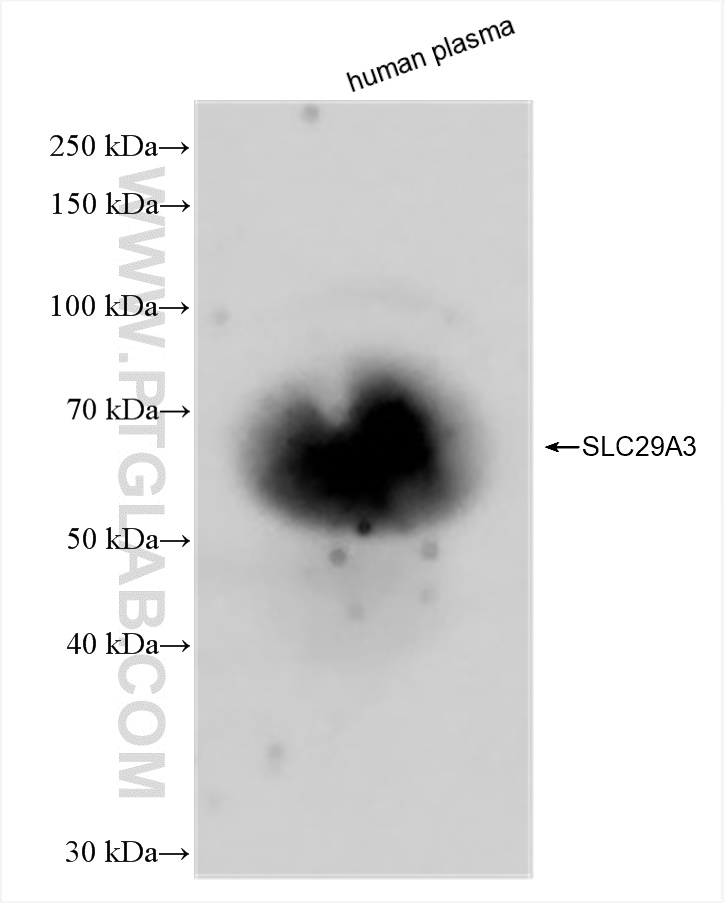 WB analysis of human plasma using 83036-1-RR (same clone as 83036-1-PBS)