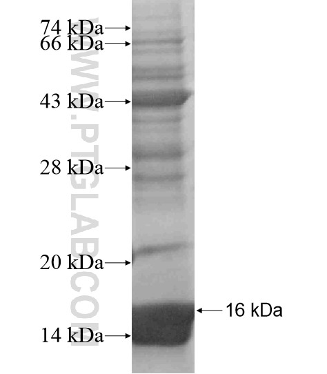 SLC29A3 fusion protein Ag18662 SDS-PAGE SLC29A3 fusion protein Ag18662 SDS-PAGE