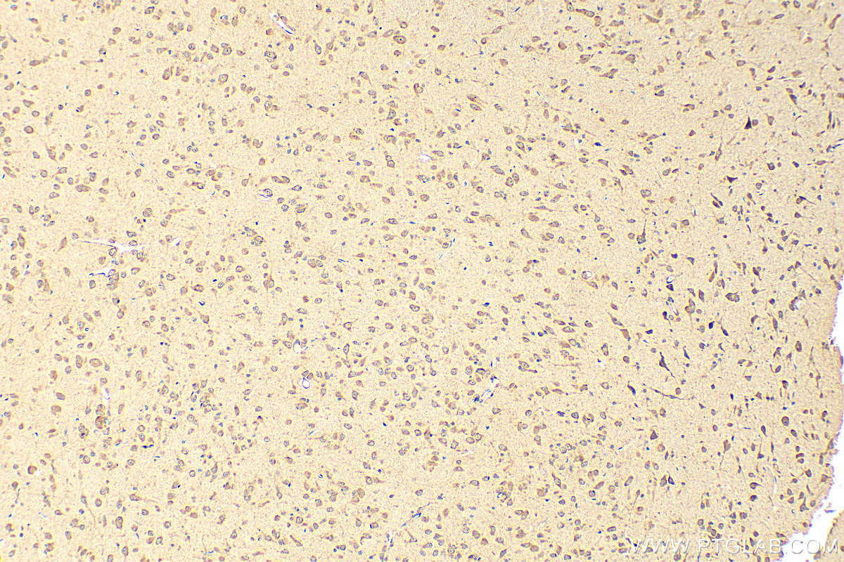 IHC staining of rat brain using 26423-1-AP