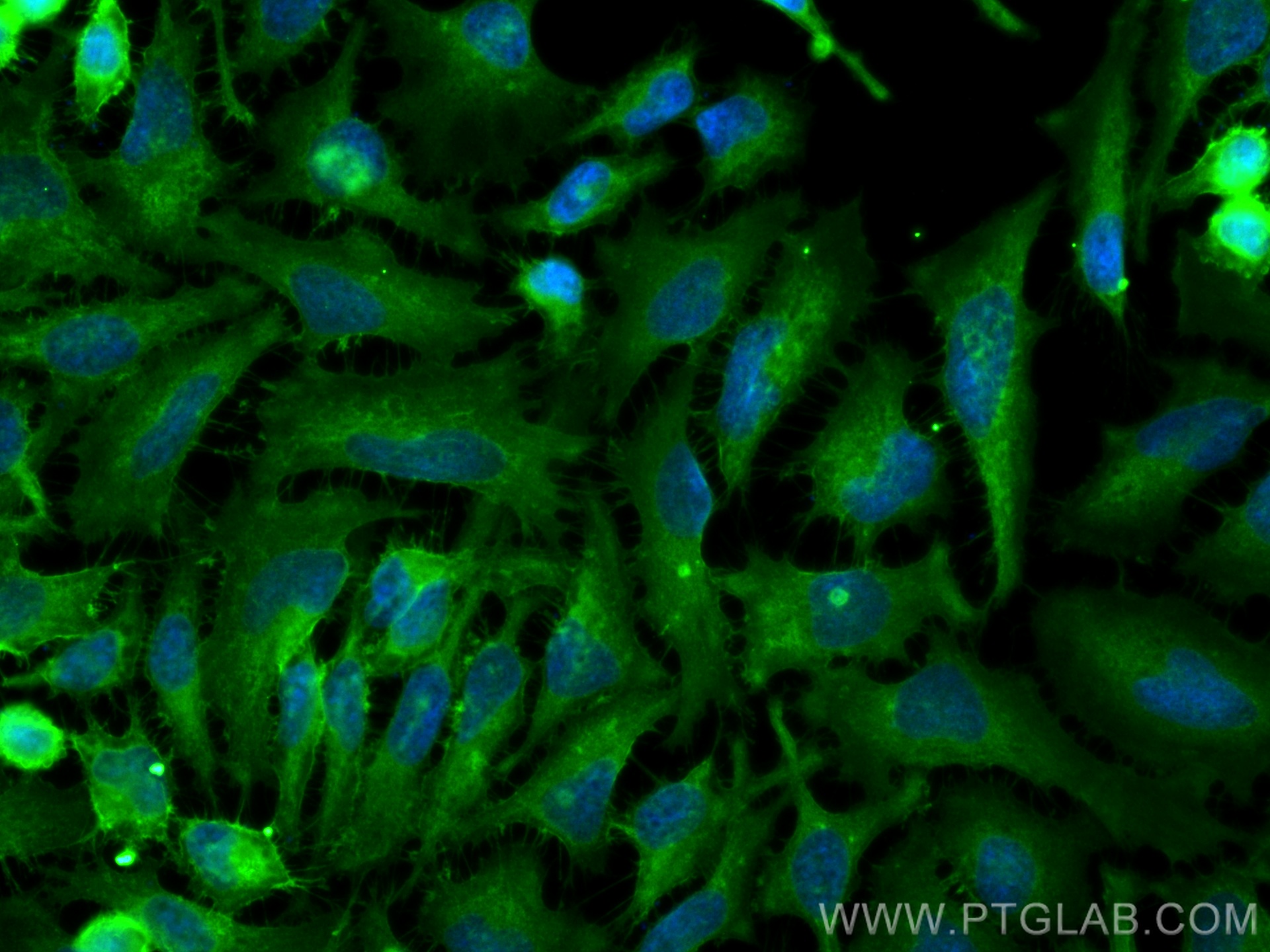 IF Staining of HeLa using 21829-1-AP