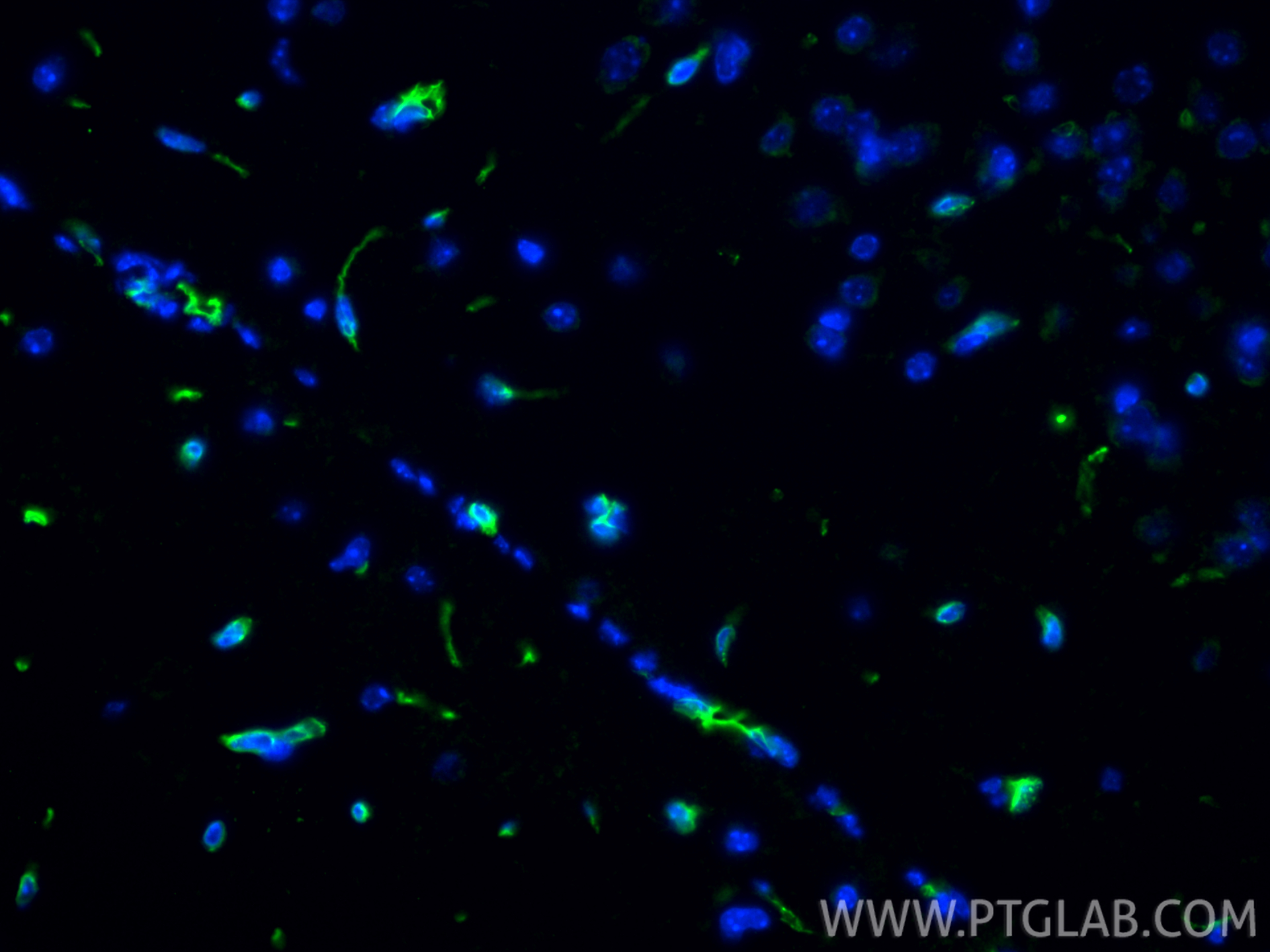 IF Staining of mouse brain using 21829-1-AP