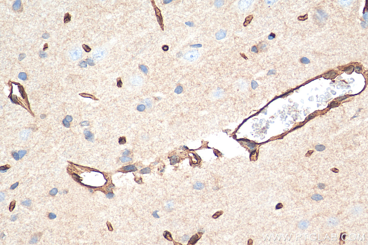 IHC staining of rat brain using 21829-1-AP