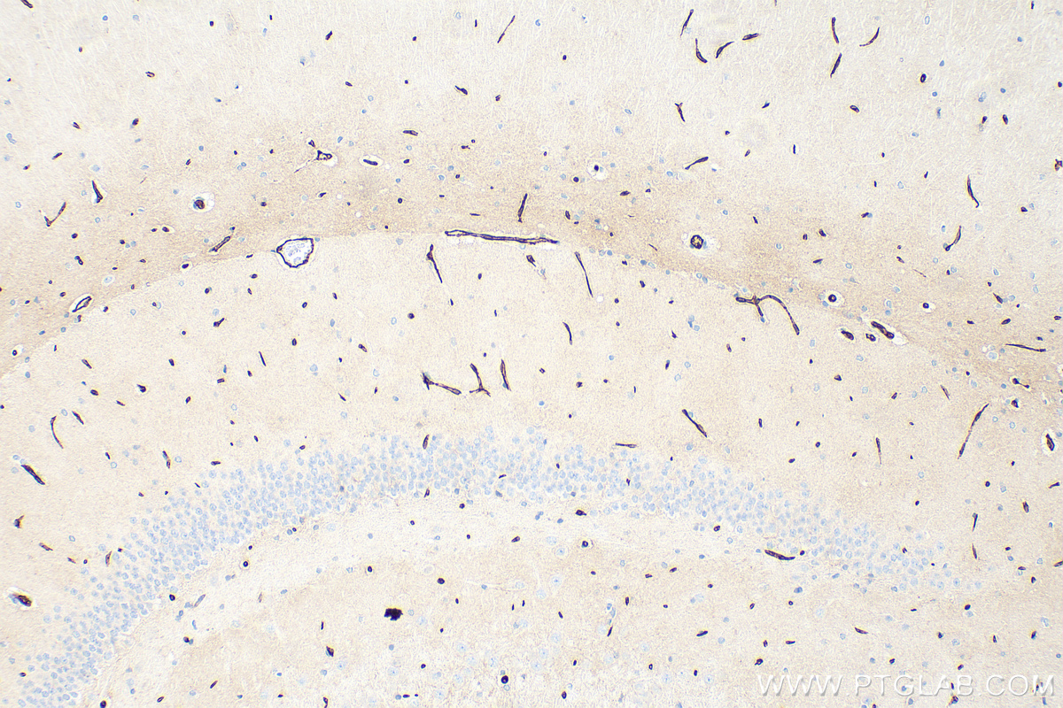 IHC staining of rat brain using 21829-1-AP