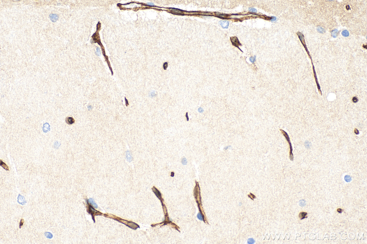 IHC staining of rat brain using 21829-1-AP