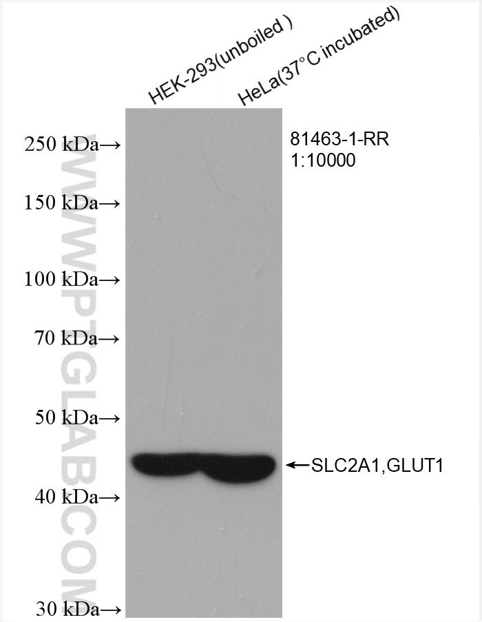 WB analysis using 81463-1-RR