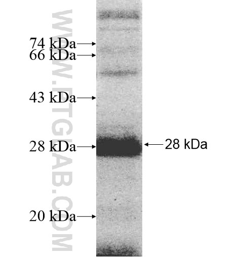 SLC2A12 fusion protein Ag10480 SDS-PAGE SLC2A12 fusion protein Ag10480 SDS-PAGE