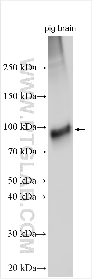 SLC2A13