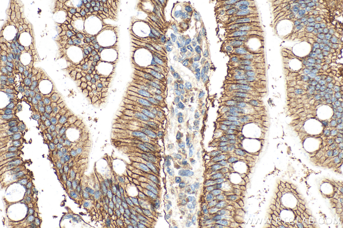 IHC staining of human small intestine using 20436-1-AP