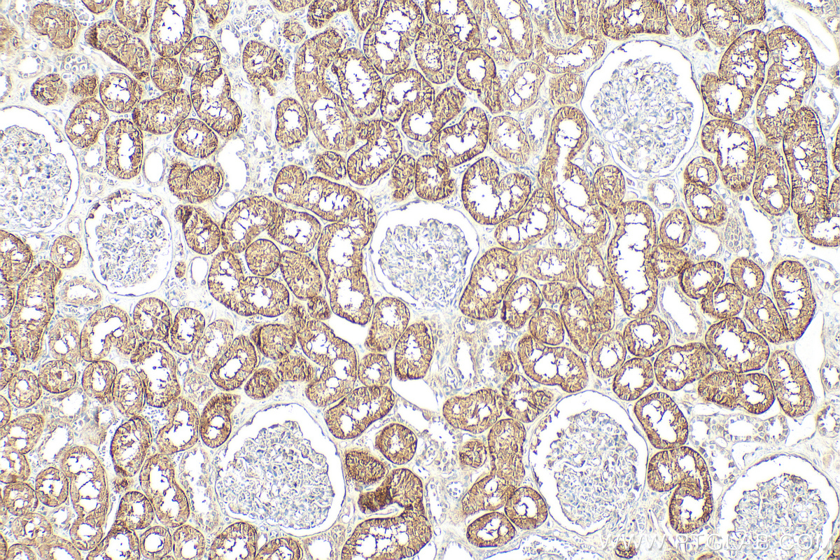 IHC staining of human kidney using 20436-1-AP