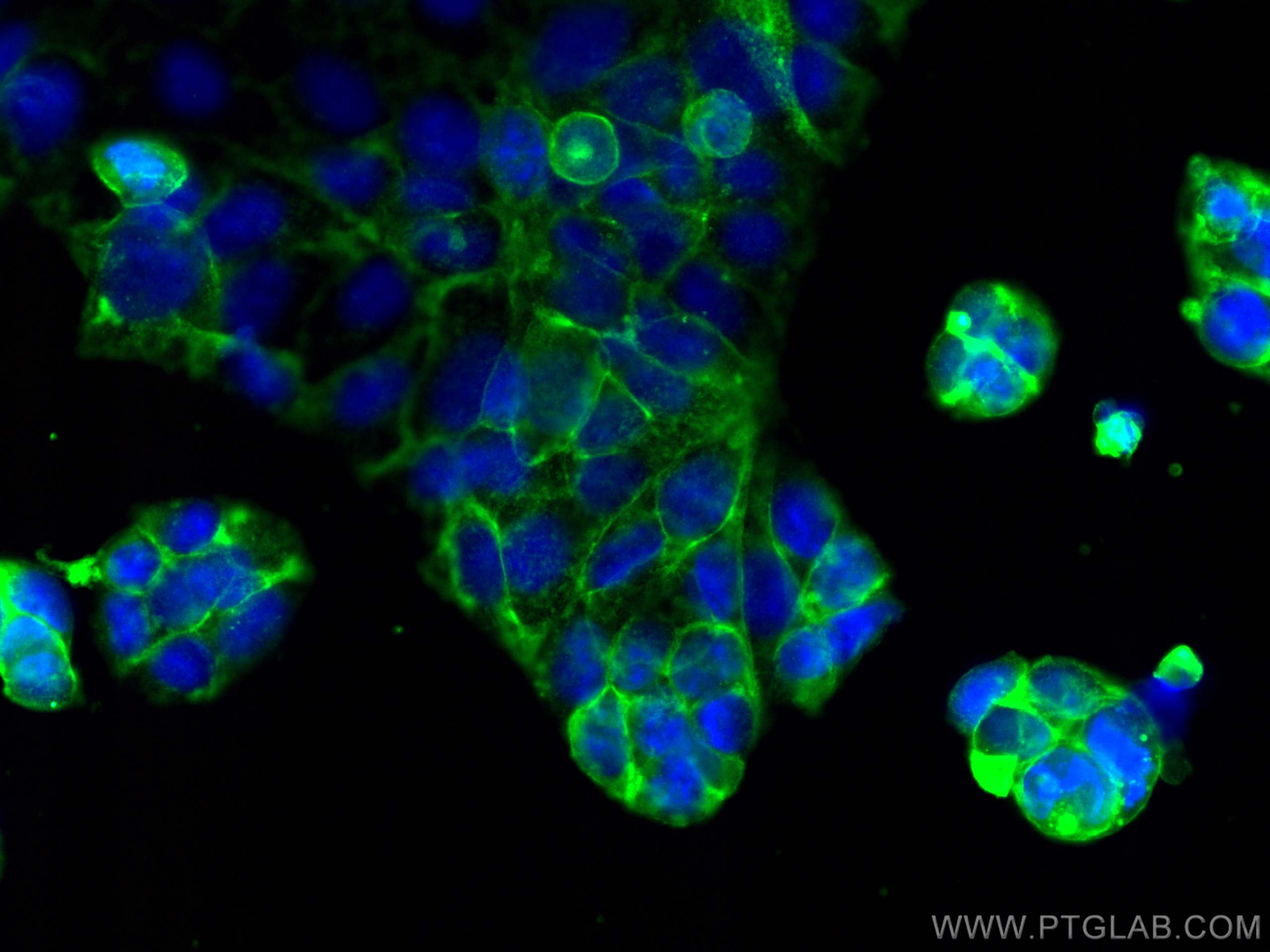 IF Staining of Caco-2 using 20403-1-AP