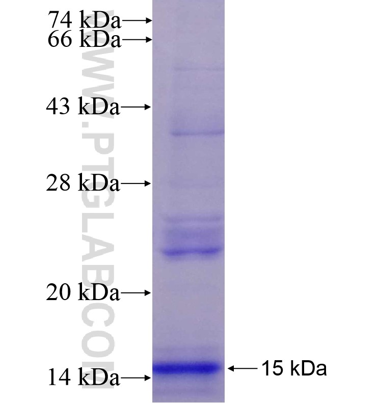 GLUT4 fusion protein Ag16920 SDS-PAGE GLUT4 fusion protein Ag16920 SDS-PAGE