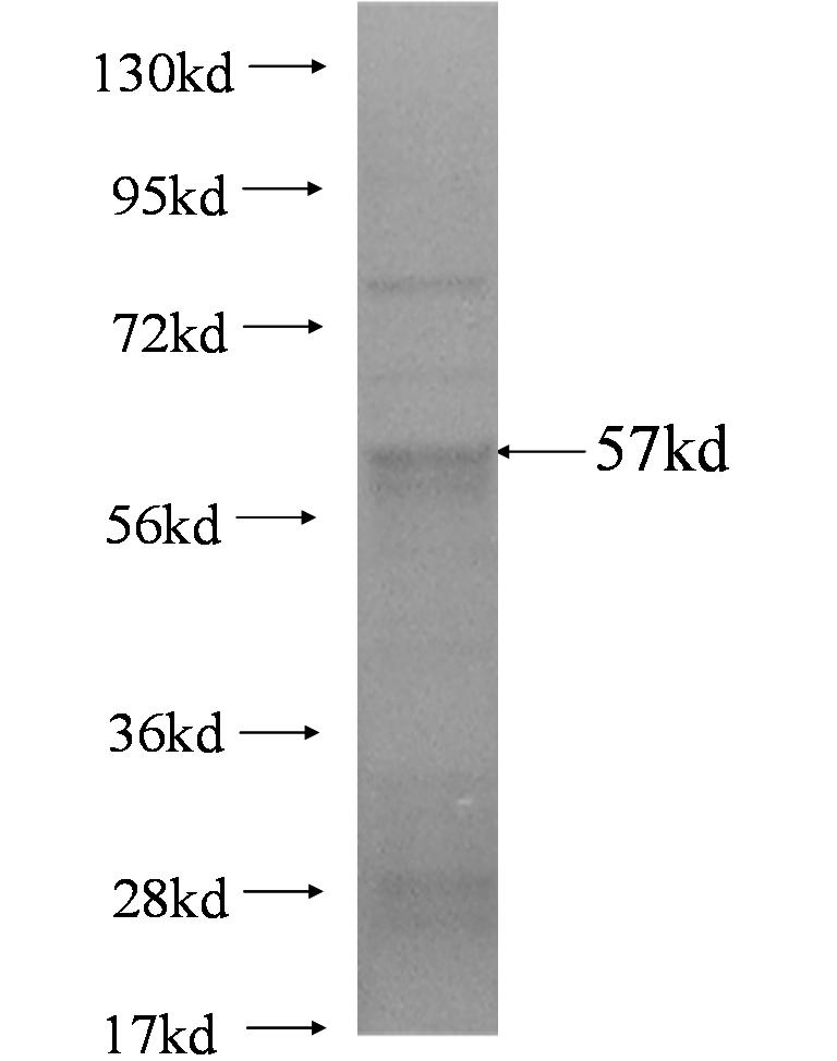 SLC2A5 fusion protein Ag3007 SDS-PAGE SLC2A5 fusion protein Ag3007 SDS-PAGE