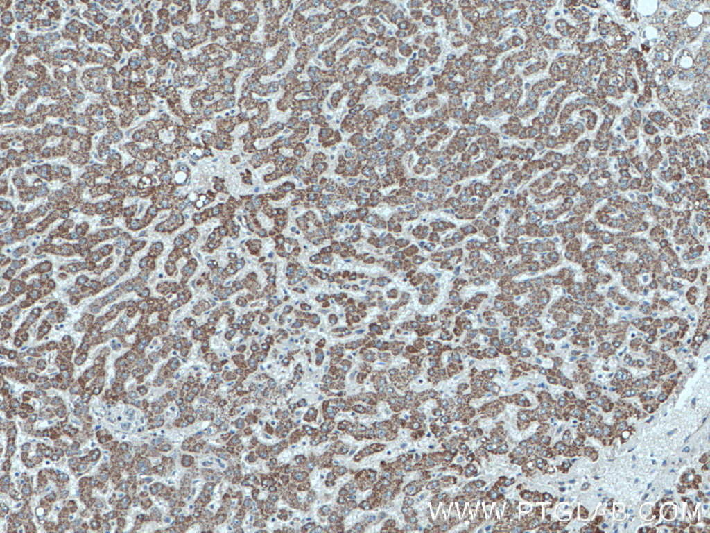 IHC staining of human liver using 26486-1-AP