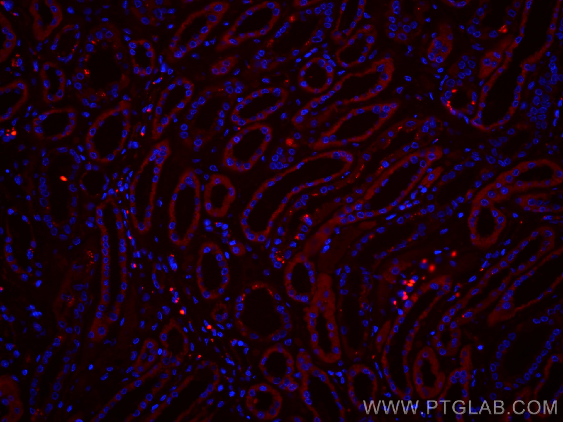 IF Staining of human kidney using CL594-67530