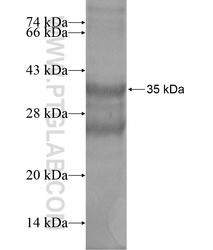 SLC2A9 fusion protein Ag18480 SDS-PAGE SLC2A9 fusion protein Ag18480 SDS-PAGE