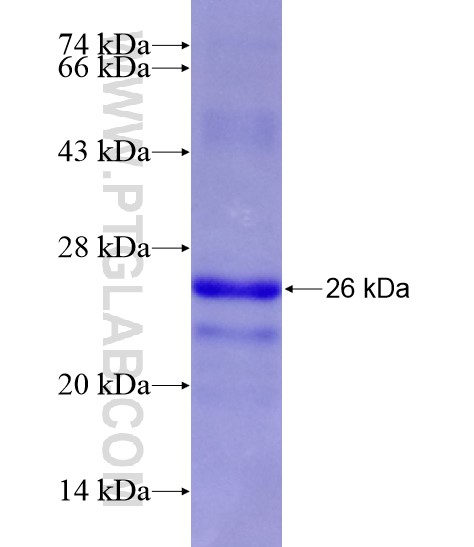 SLC30A1 fusion protein Ag18666 SDS-PAGE SLC30A1 fusion protein Ag18666 SDS-PAGE