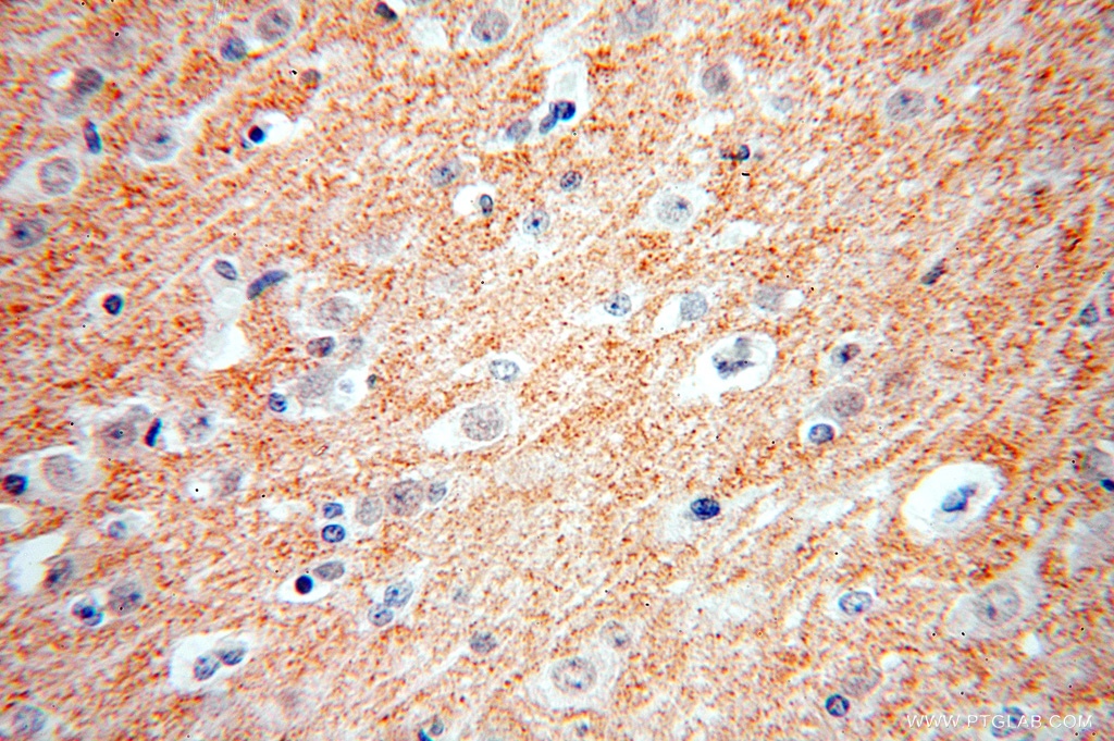 ZnT3 Polyclonal antibody