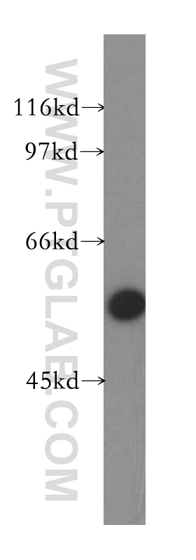 ZnT6 Polyclonal antibody