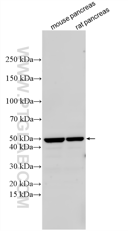 Various lysates were subjected to SDS PAGE followed by western blot with 16169-1-AP (SLC30A8/ZNT8-Specific antibody) at dilution of 1:1000 incubated at room temperature for 1.5 hours. WB analysis using 16169-1-AP