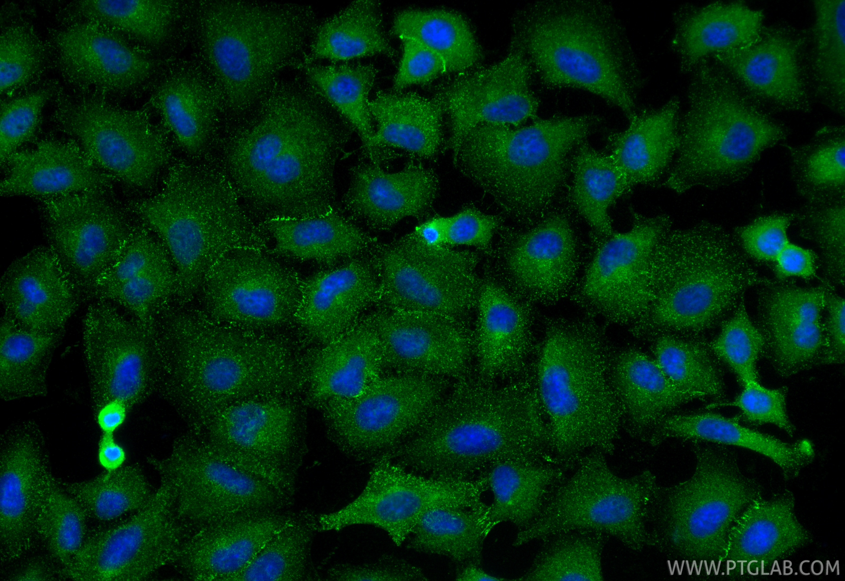 IF Staining of A549 using 27499-1-AP IF Staining of A549 using 27499-1-AP