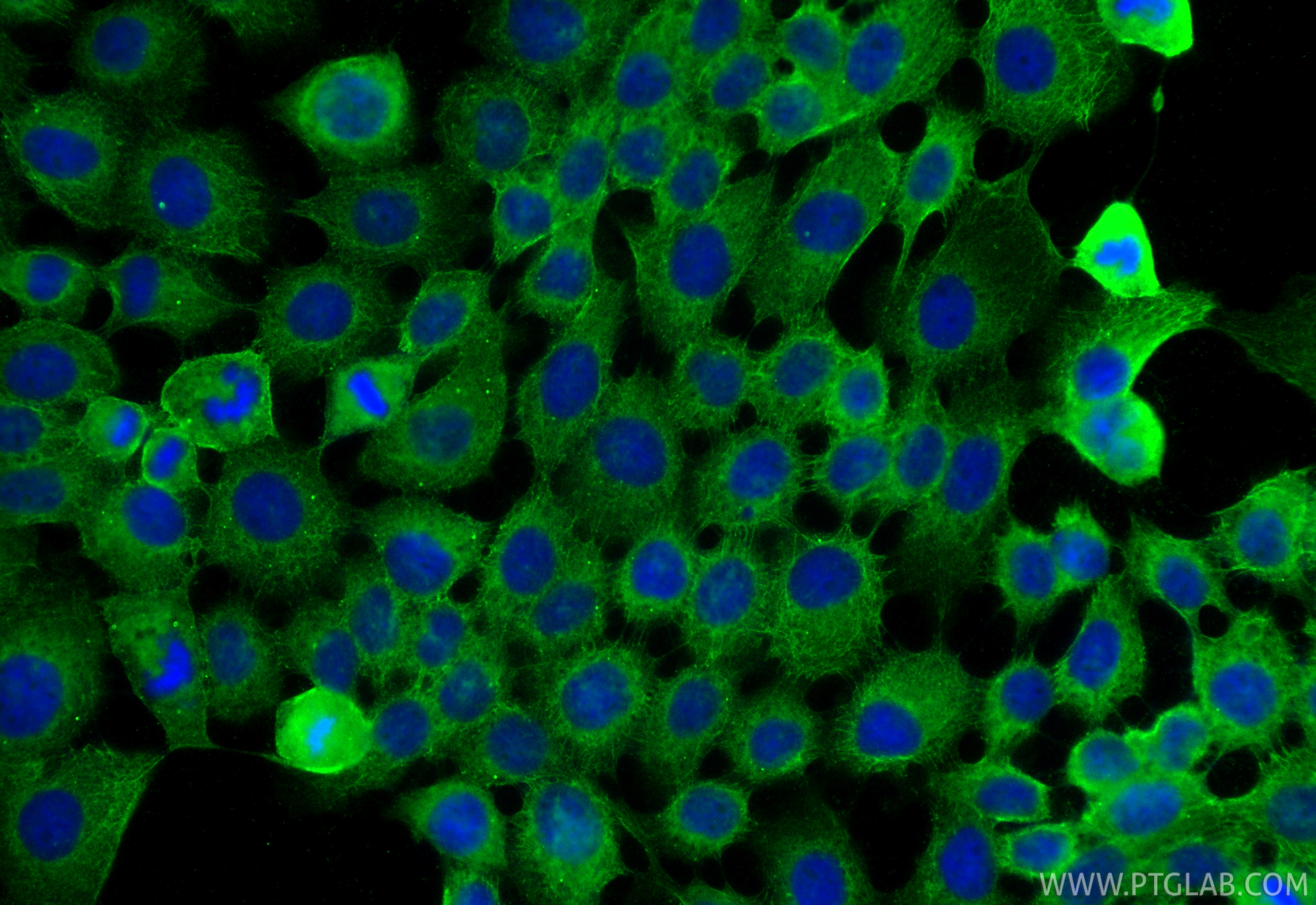 IF Staining of A431 using 67221-1-Ig IF Staining of A431 using 67221-1-Ig