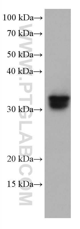 WB analysis of HeLa using 67221-1-Ig