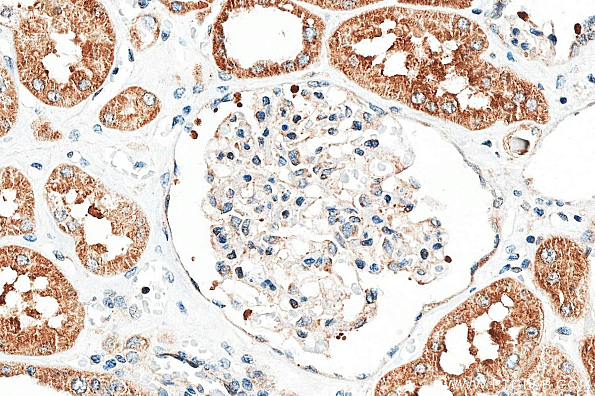 IHC staining of human kidney using 83844-5-RR (same clone as 83844-5-PBS)