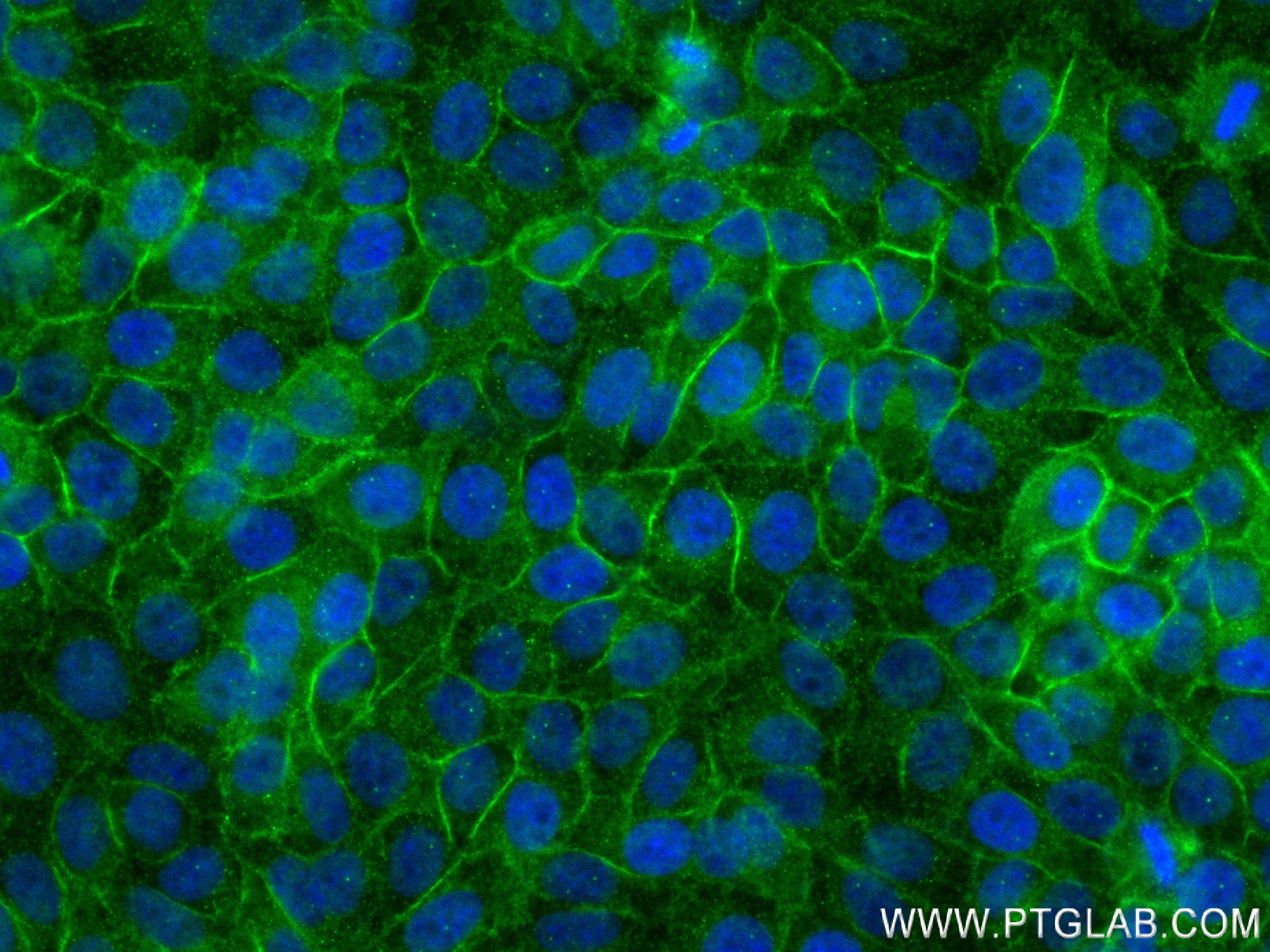 IF Staining of HepG2 using 83844-6-RR