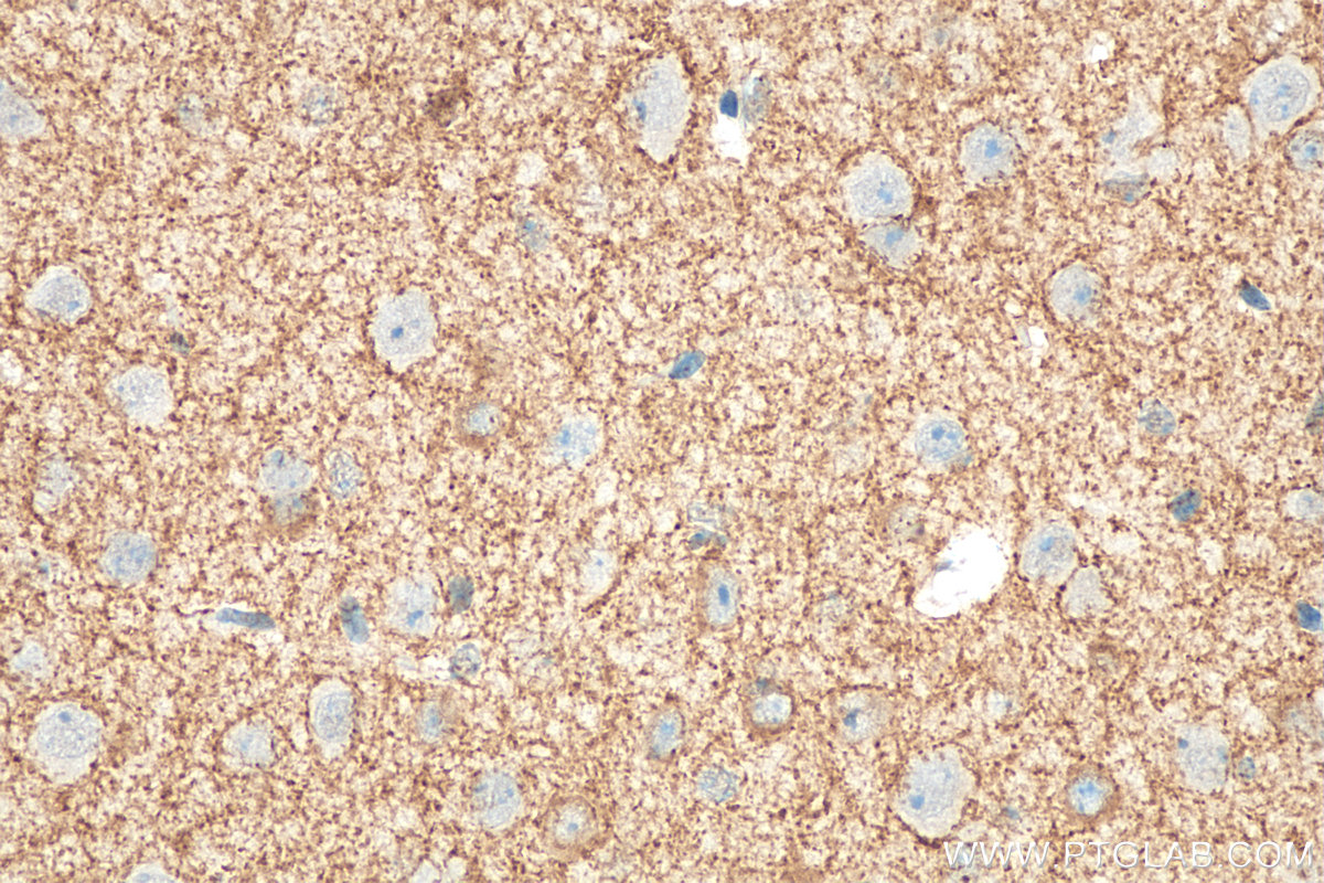 IHC staining of mouse brain using 14471-1-AP