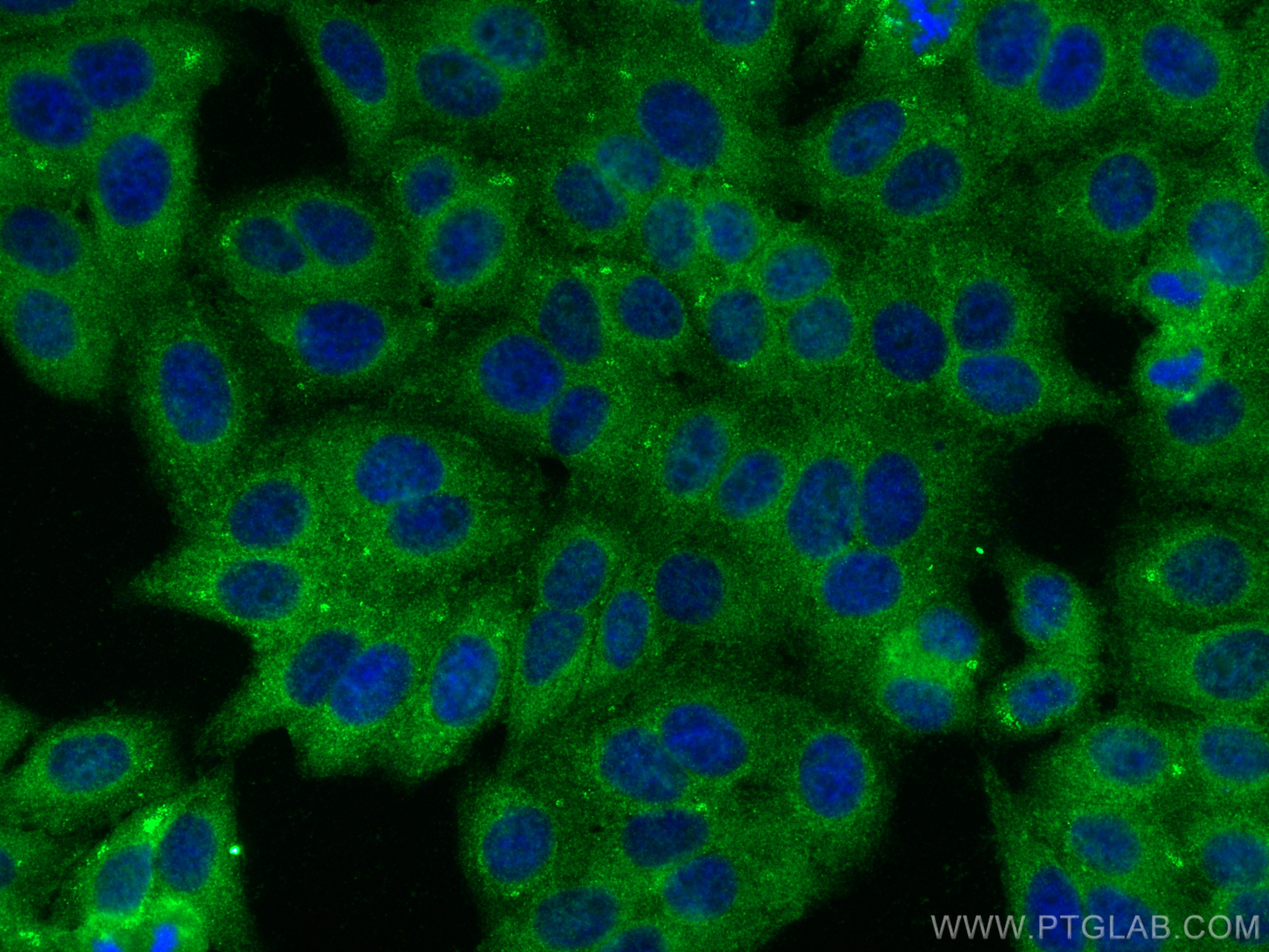 IF Staining of HepG2 using 16342-1-AP