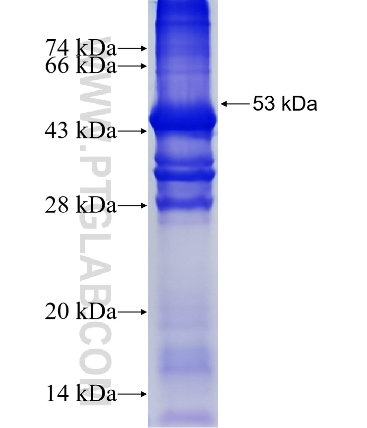 SLC35A2 fusion protein Ag4524 SDS-PAGE