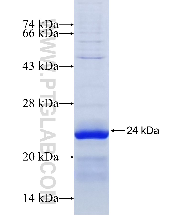 SLC35A4 fusion protein Ag10635 SDS-PAGE SLC35A4 fusion protein Ag10635 SDS-PAGE