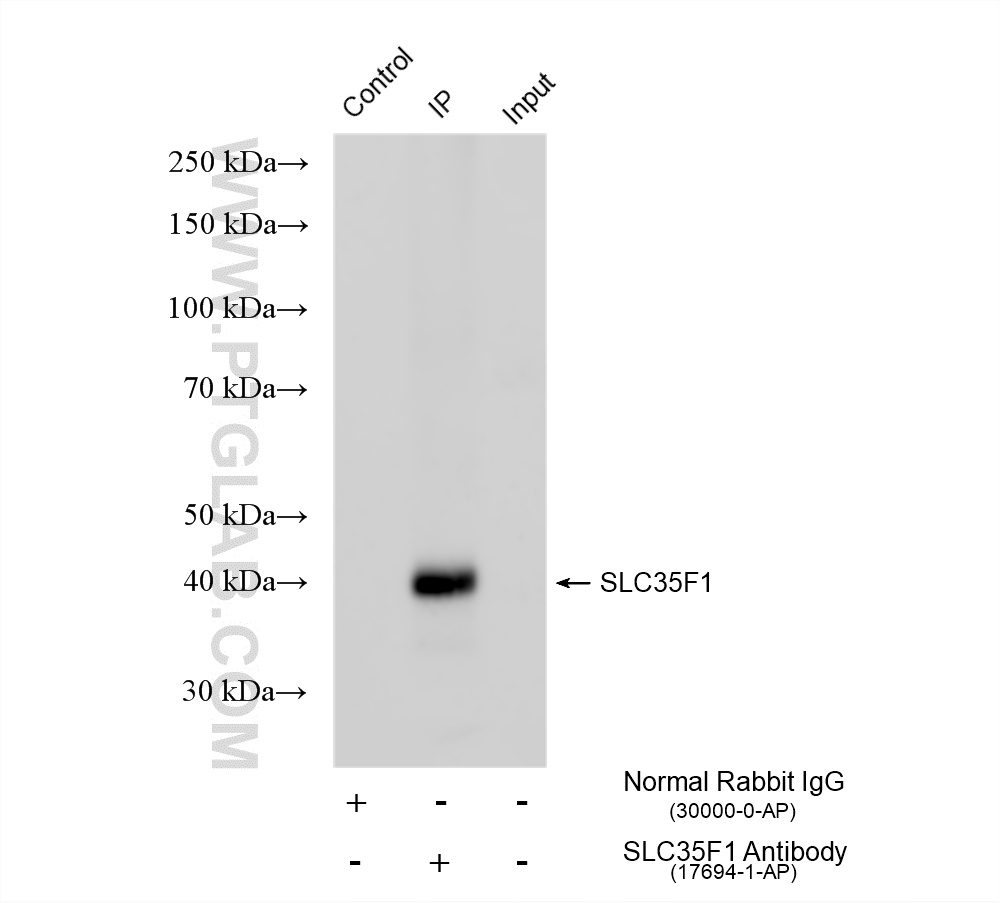 IP experiment of rat brain using 17694-1-AP IP experiment of rat brain using 17694-1-AP