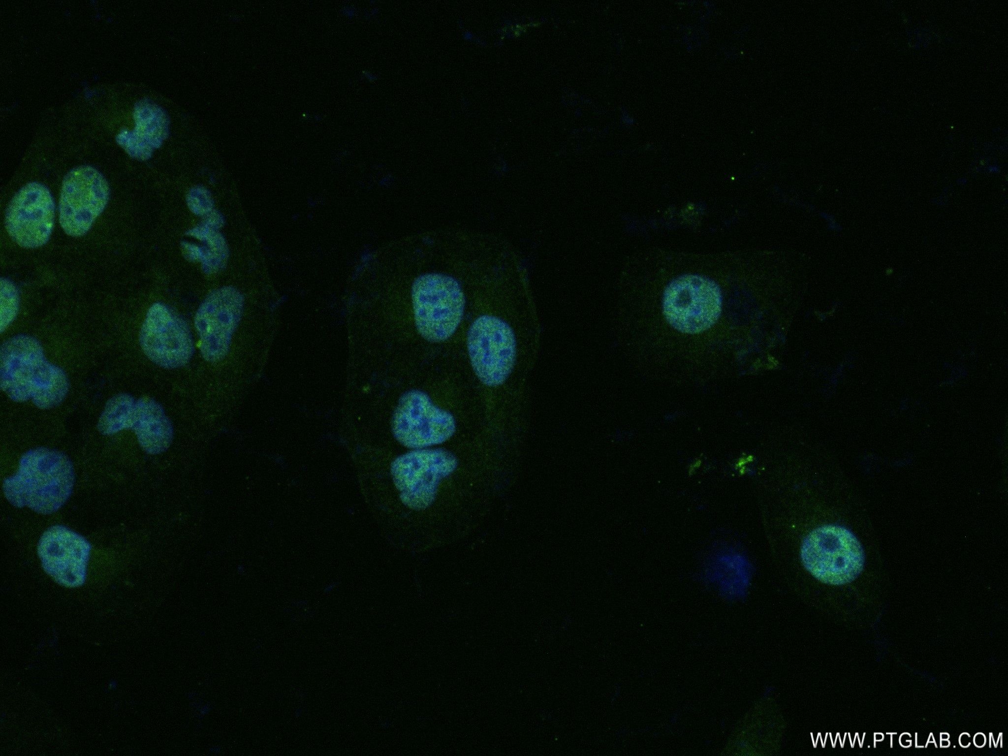 IF Staining of U2OS using 83085-3-RR
