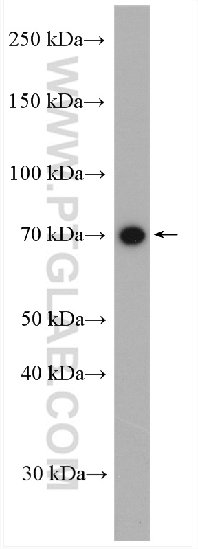 WB analysis of mouse spleen using 20469-1-AP (same clone as 20469-1-PBS)