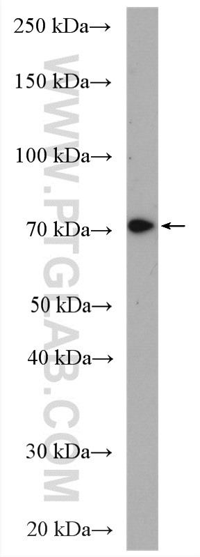 WB analysis of mouse thymus using 20469-1-AP