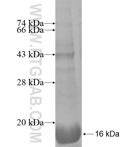 SLC37A3 fusion protein Ag14813 SDS-PAGE SLC37A3 fusion protein Ag14813 SDS-PAGE
