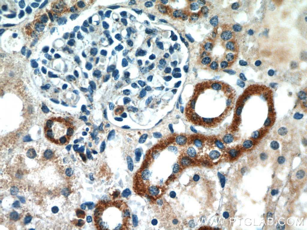 IHC staining of human kidney using 20612-1-AP