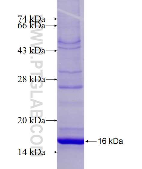 SLC37A4 fusion protein Ag14807 SDS-PAGE SLC37A4 fusion protein Ag14807 SDS-PAGE