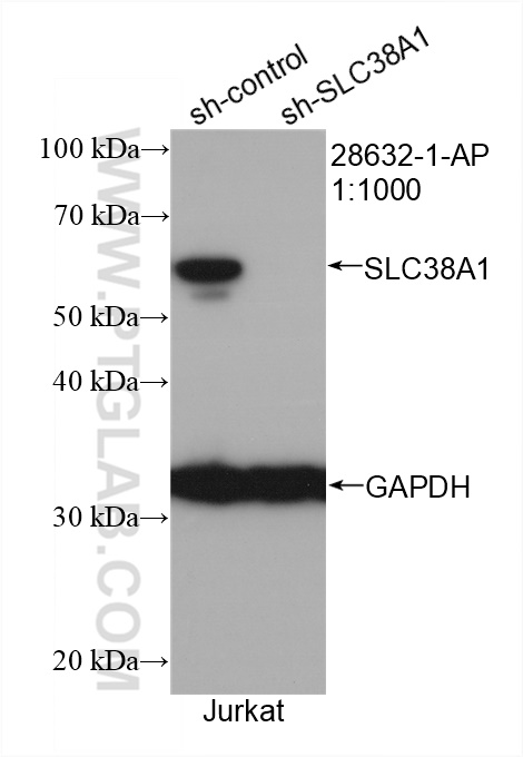 WB analysis of HeLa using 28632-1-AP