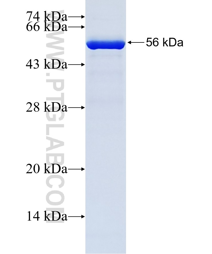 SLC38A10 fusion protein Ag38490 SDS-PAGE SLC38A10 fusion protein Ag38490 SDS-PAGE