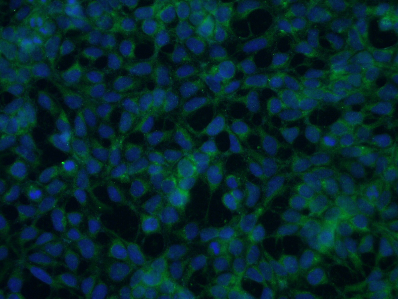 IF Staining of HEK-293 using 14315-1-AP