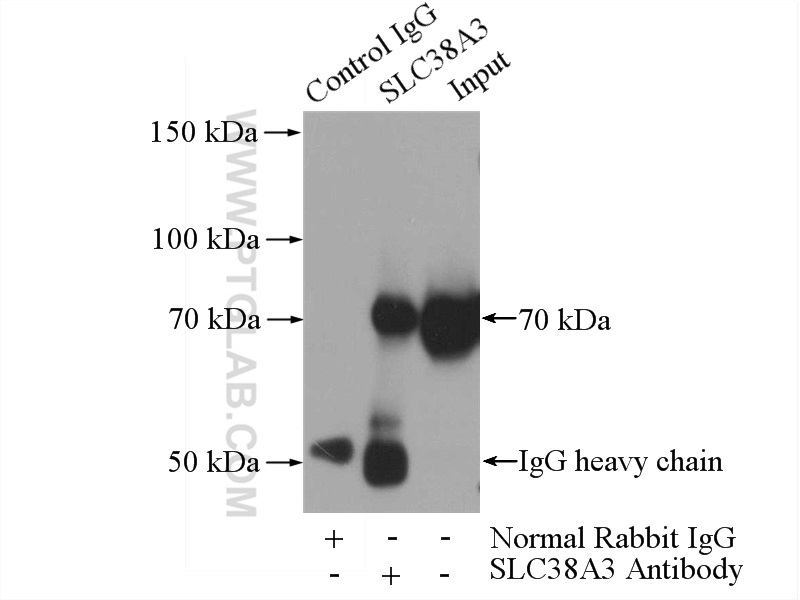 IP experiment of mouse heart using 14315-1-AP