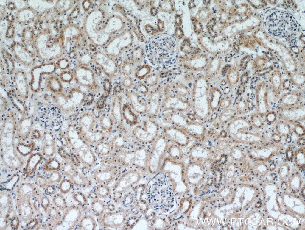 IHC staining of human kidney using 20857-1-AP