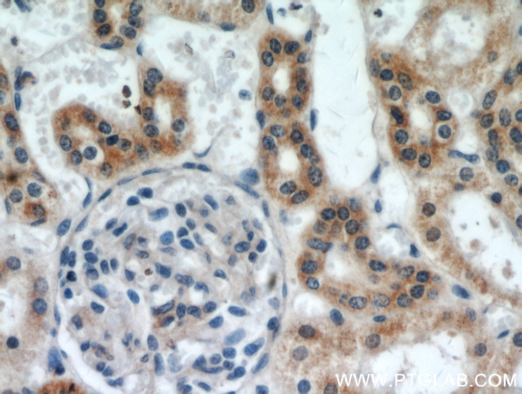 IHC staining of human kidney using 20857-1-AP